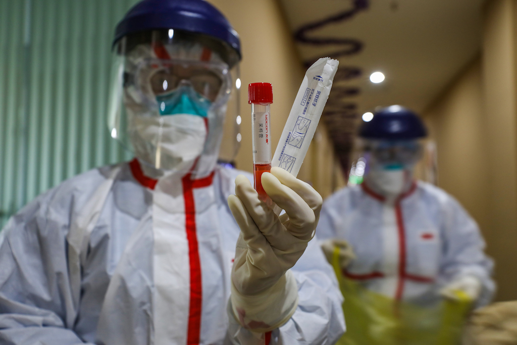 Coronavirus: China reports 109 new deaths and 397 new confirmed cases