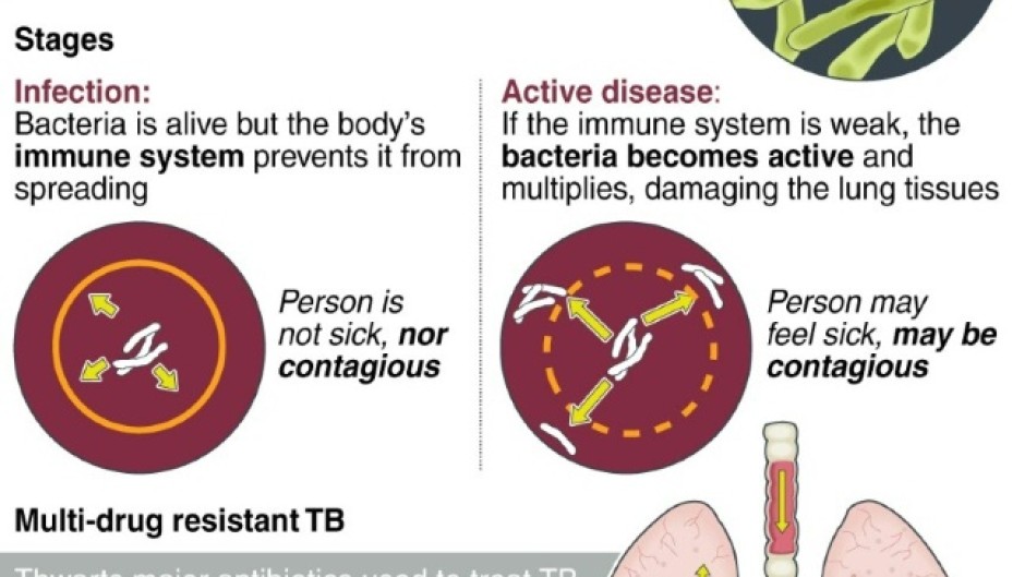 Beginning Of The End Patients Hail New Treatment For Drug Resistant   Doc 32HD92N %2540photo1 .webp