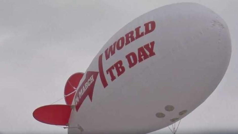 World TB Day was celebrated on Sunday.