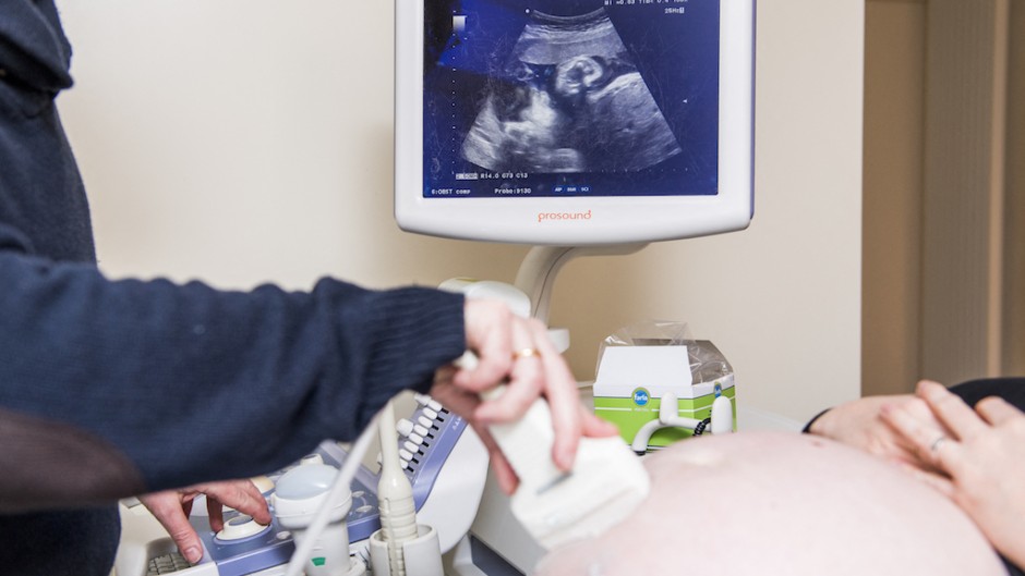 File: A doctor doing an ultrasound examination of a pregnant woman. Jasper Jacobs/Belga/AFP