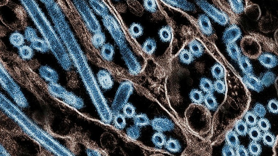 A colorized transmission electron micrograph of avian influenza A H5N1 virus particles (blue), grown in Madin-Darby Canine Kidney (MDCK) epithelial cells