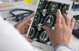 File: Doctor viewing brain scans. TEK IMAGE/ABO/Science Photo Library via AFP