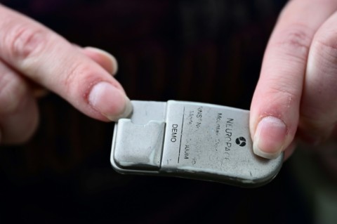 Amber Pearson shows a model of a brain implant she received at the Oregon Health and Science University (OHSU) hospital in Portland, Oregon on 