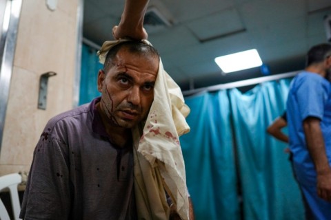 A Palestinian man waits for treatment at a hospital in Deir al-Balah