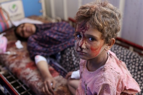 An injured child at a Gaza City hospital following Israeli bombardment of schools housing displaced Palestinians