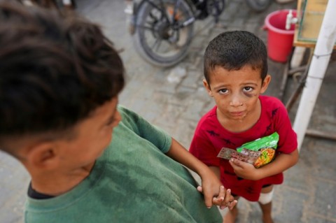 An injured child holds food in Khan Yunis, southern Gaza -- food shortages are widespread after 10 months of war in the Palestinian territory