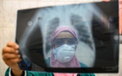 An Egyptian doctor wearing two protective masks checks a patient's lung X-ray at the infectious diseases unit of the Imbaba hospital in the capital Cairo, during the COVID-19 coronavirus pandemic crisis.