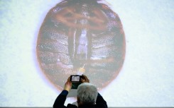 South Korea has seen a surge in bedbug infestations, with more than 100 cases reported since late November