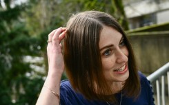 Amber Pearson, who received a brain implant to treat her epilepsy and Obsessive Compulsive disorder (OCD), shows the approximate placement of a brain implant received at the Oregon Health and Science University (OHSU) hospital in Portland, Oregon