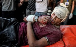 A youth wounded in an Israeli bombardment at Bureij is treated at the Al-Aqsa Martyrs hospital in central Gaza