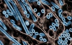 A colorized transmission electron micrograph of avian influenza A H5N1 virus particles (blue), grown in Madin-Darby Canine Kidney (MDCK) epithelial cells